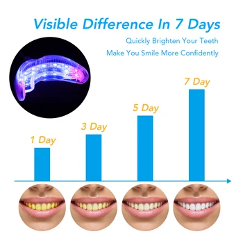 Dantų Balinimo Didelio Stiprumo LED Mėlyno Lazerio Peroksidas Dantų Balinimo Sistema, Burnos Gelis Nustatyti, Burnos Higienos Priemonės Dantų Priežiūros