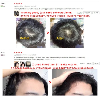 OMY LADY Kovos su Plaukų Slinkimas Plaukų Augimą Purškimo eterinis Aliejus Skystas Vyrų, Moterų Sausų Plaukų atgaivinimo Remonto Plaukų Slinkimas Produktų
